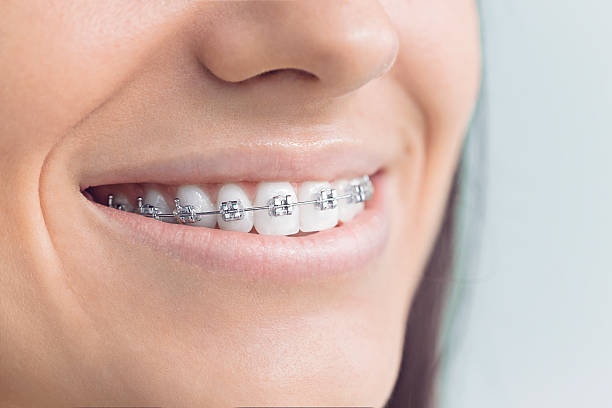 Best Veneers and Lumineers  in Minot, ND